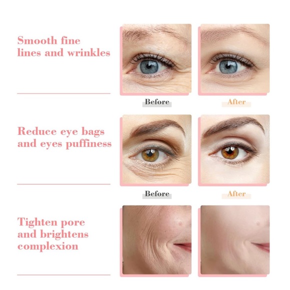 NIB slashome Ice Globes for Facials, Facial Cooling Neck & Eyes with Headband - Picture 4 of 5